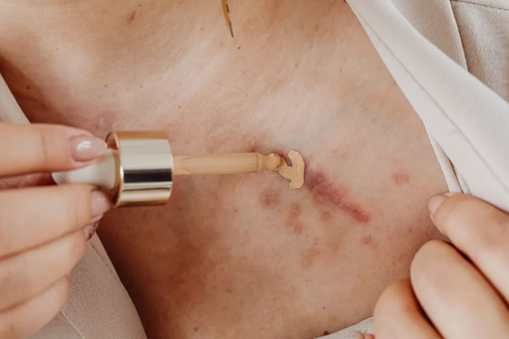 My Perspective on SkinBetter Science: Unpacking Its Unique Approach to Skincare